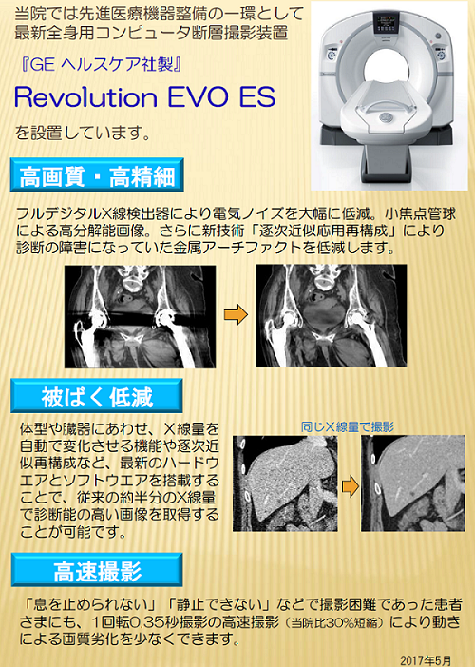 CT（コンピュータ断層撮影装置）の新機種（Revolution EVO ES）を導入しました